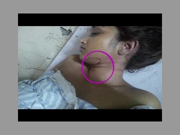 చున్నీతో ఉరి వేసుకోవడం వల్ల :