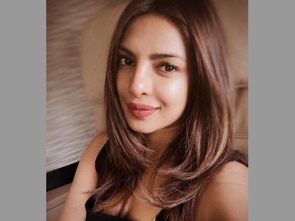 అనుష్క శర్మా లిప్ సర్జరి
