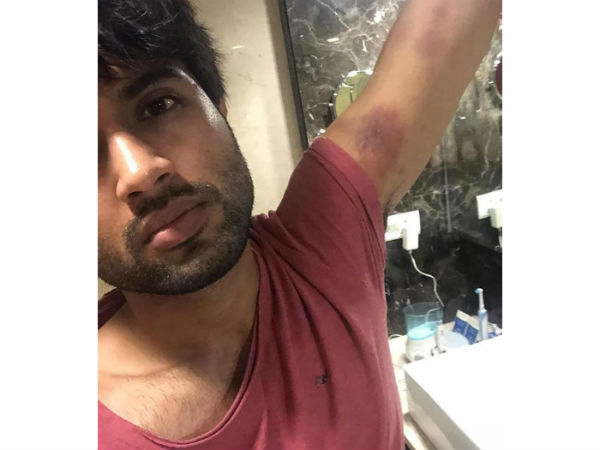 Actor Vijay Devarakonda injurie pic goes viral Actor Vijay Devarakonda injurie pic goes viral