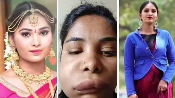 డాక్టర్ సలహాతో